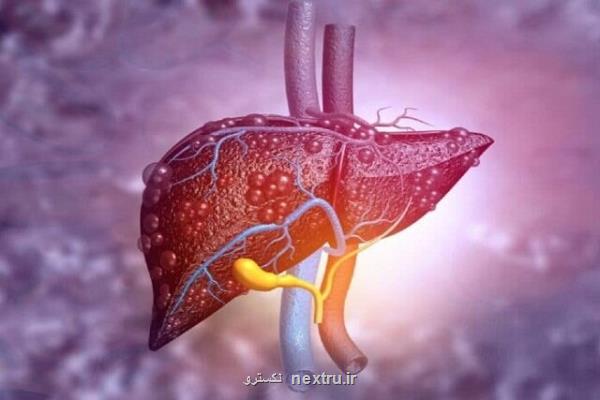 عوارض جانبی غیرمنتظره دم نوش کاسنی در مبتلایان به کبد چرب