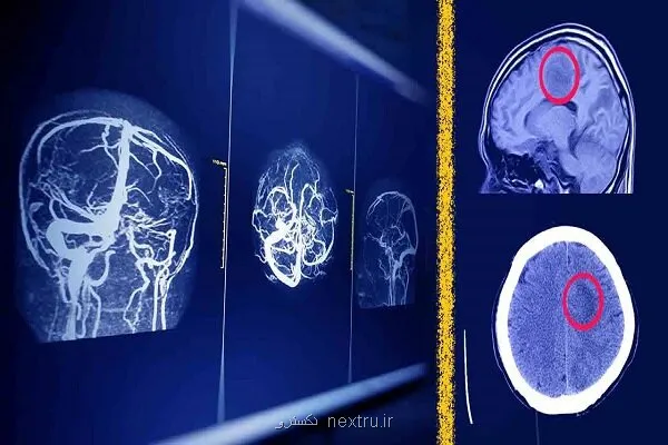 پیش بینی آینده رادیولوژیست ها باوجود هوش مصنوعی